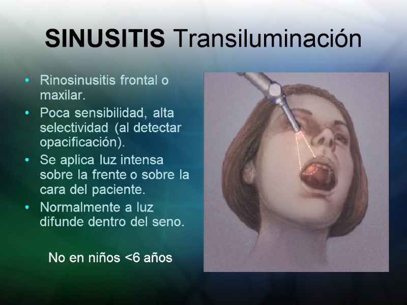 SINUSITIS Transiluminación Rinosinusitis frontal o maxilar. Poca sensibilidad, alta selectividad (al detectar opacificación). Se